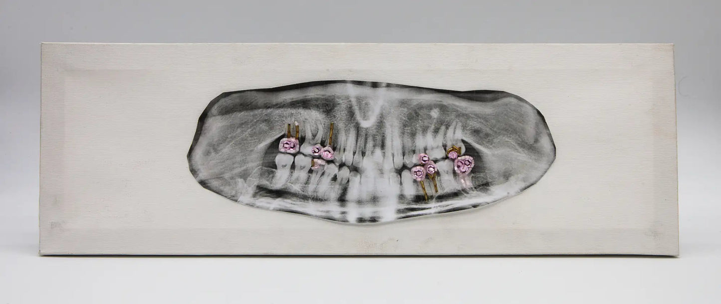 Elisabette Zelaya : Mâchoire -  Tableau