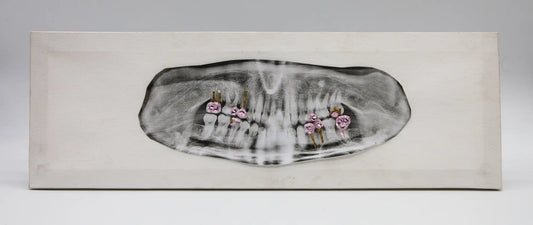 Elisabette Zelaya : Mâchoire -  Tableau